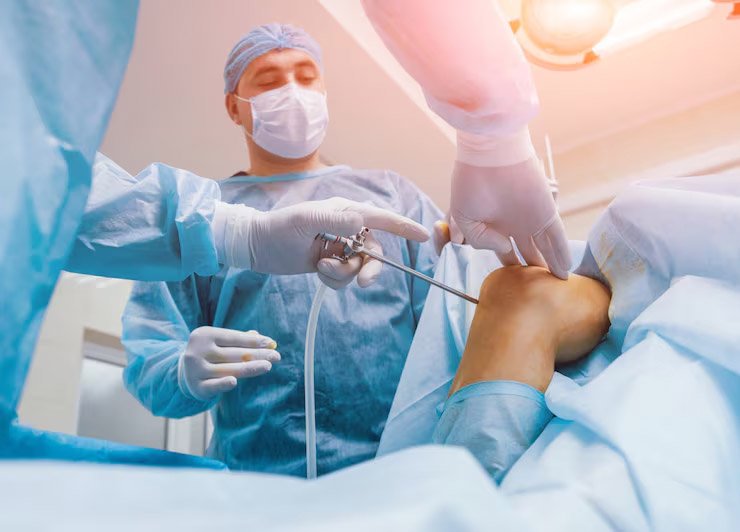 Arthroscopic Knee Surgery in Bangalore